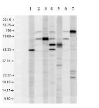 KDEL | Endoplasmic reticulum retention signal in the group Antibodies Plant/Algal  / Membrane Transport System / Endomembrane system at Agrisera AB (Antibodies for research) (AS13 2665)